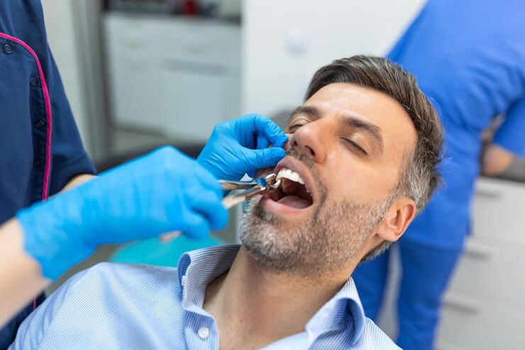 Teeth Extraction in JP Nagar Bengaluru